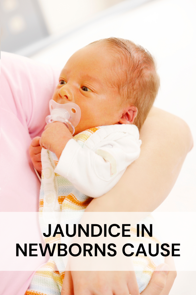 How to prevent jaundice in newborns